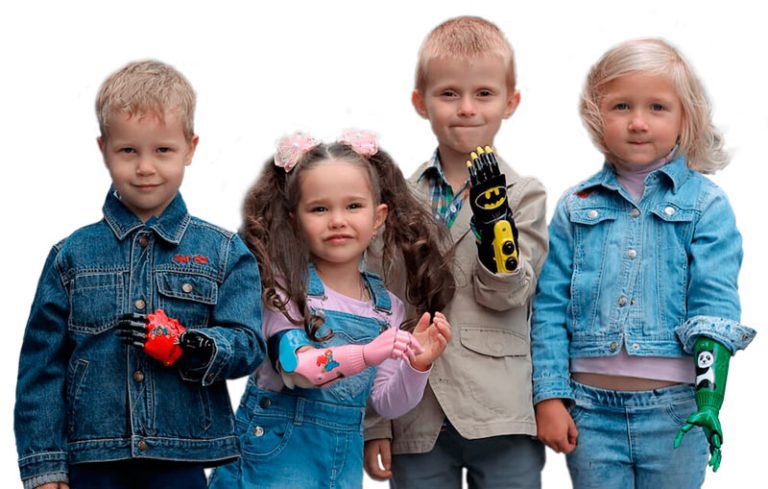 Prosthetics Kids